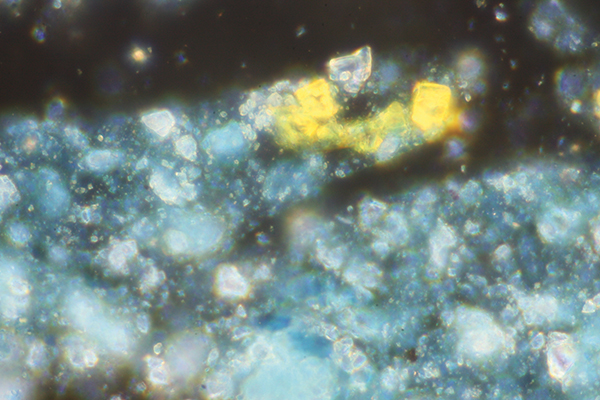 Pigment grains in reflected polarised light (1000x magnification)The silhouette of pigment grains becomes observable in reflected light.